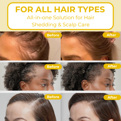 BeeRooted™ Hair Growth Ampoule