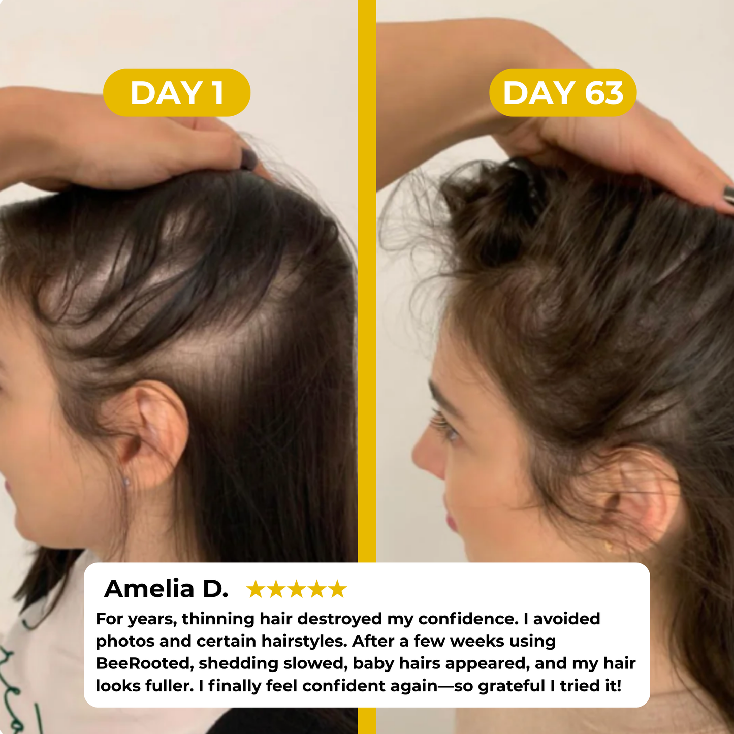 BeeRooted™ Hair Growth Ampoule